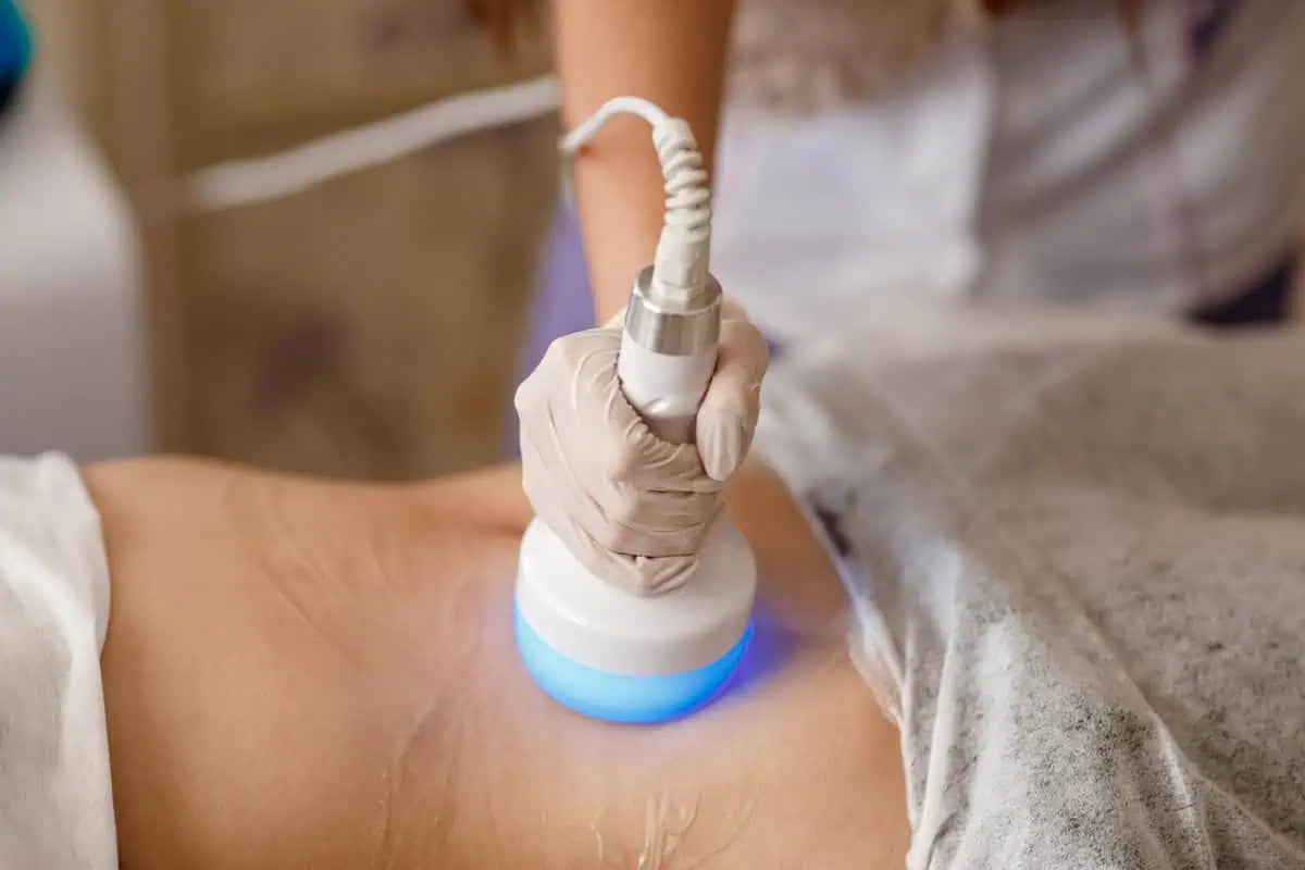 Cryothermo Body Contouring